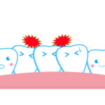 歯並びが悪い人に起こる歯に関するトラブル