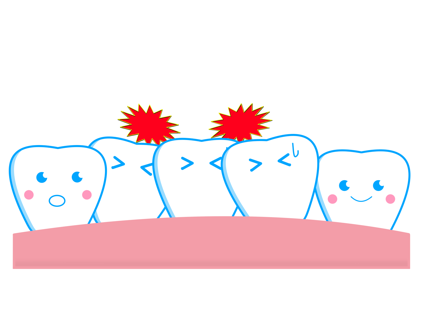 歯並びが悪い人に起こる歯に関するトラブル