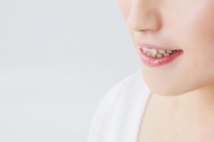 歯の矯正の種類はどれくらい？実際にかかる費用と期間は？